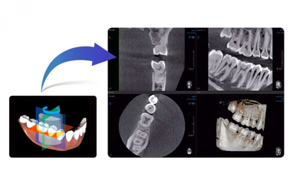歯と骨の構造を立体的に判断し、治療に役立てます